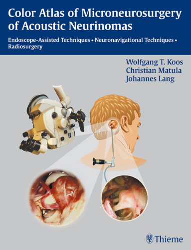Color atlas of microneurosurgery of acoustic neurinomas: endoscope-assisted techniques, neuronavigational techniques, radiosurgery