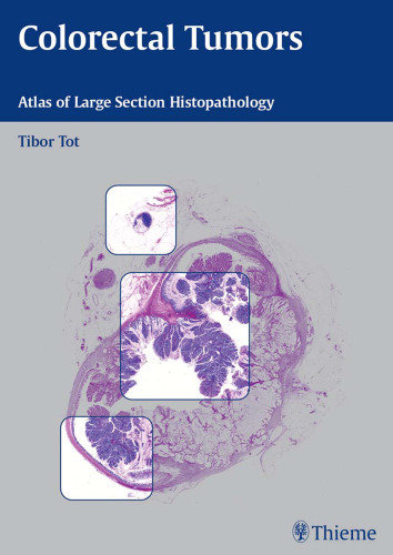 Colorectal tumors: atlas of large section histopathology