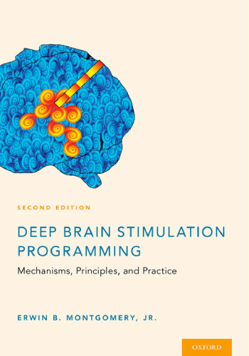 Deep brain stimulation programming: mechanisms, principles, and practice