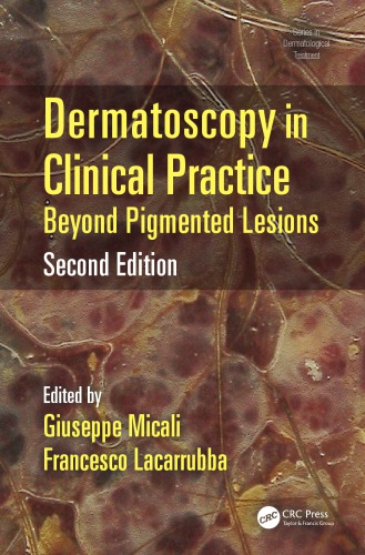 Dermatoscopy in Clinical Practice