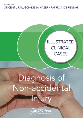 Diagnosis of Non-accidental Injury: Illustrated Clinical Cases
