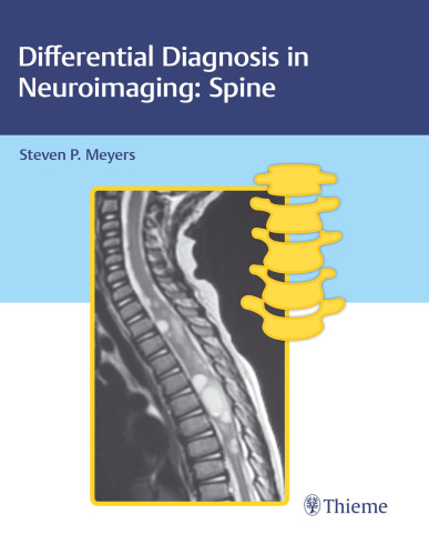 Differential diagnosis in neuroimaging. Spine