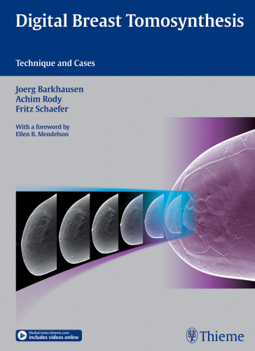 Digital breast tomosynthesis: technique and cases
