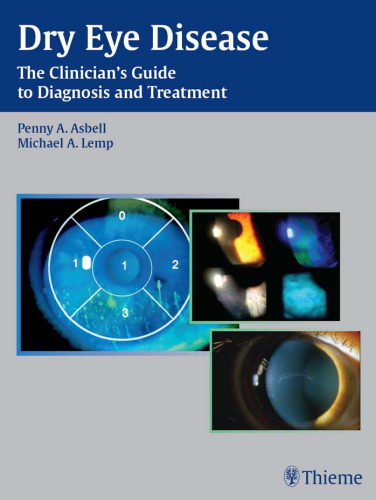 Dry eye disease: the clinician’s guide to diagnosis and treatment