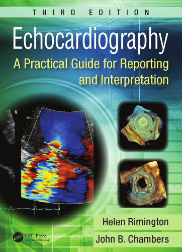 Echocardiography: a practical guide for reporting and interpretation