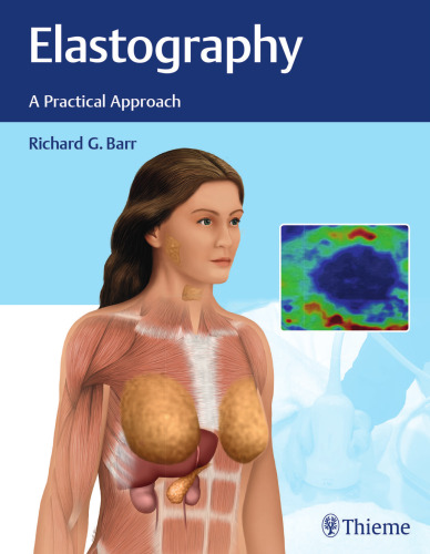 Elastography: a practical approach