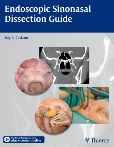 Endoscopic sinonasal dissection guide