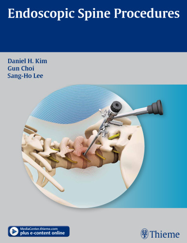 Endoscopic spine procedures