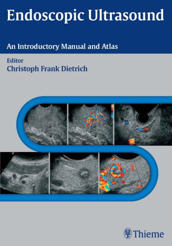 Endoscopic ultrasound: an introductory manual and atlas ; 94 tables