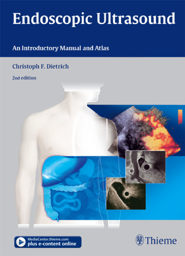 Endoscopic ultrasound: an introductory manual and atlas