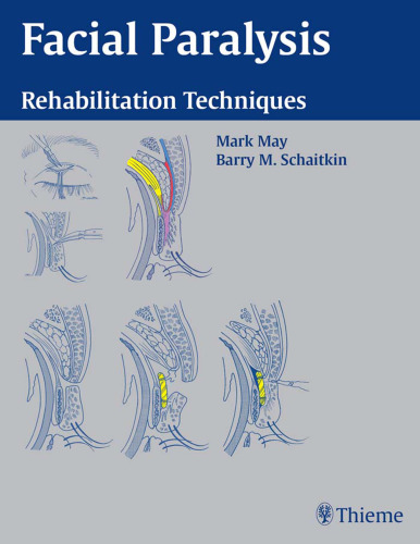 Facial paralysis: rehabilitation techniques