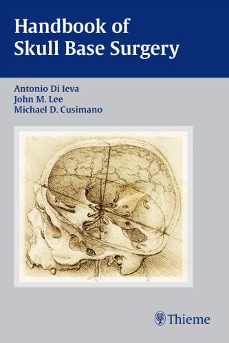 Handbook of skull base surgery