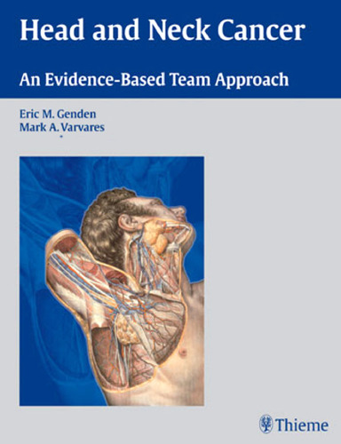 Head and neck cancer: an evidence-based team approach