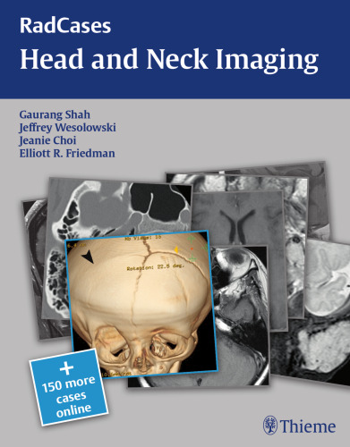 head and neck imaging