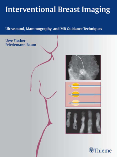 Interventional breast imaging: ultrasound, mammography, and MR guidance techniques