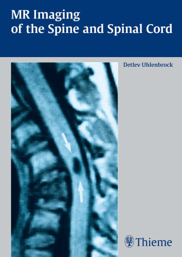 MR imaging of the spine and the spinal cord