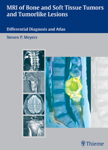 MRI of bone and soft tissue tumors and tumorlike lesions: differential diagnosis and atlas