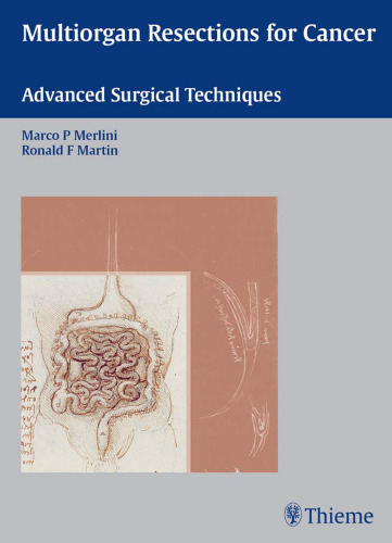 Multiorgan resections for cancer: advanced surgical techniques