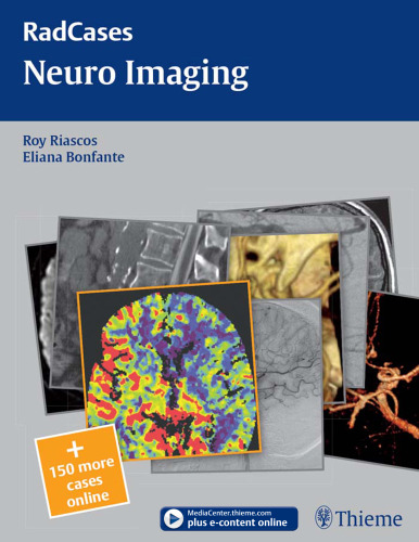 Radcases Neuro Imaging