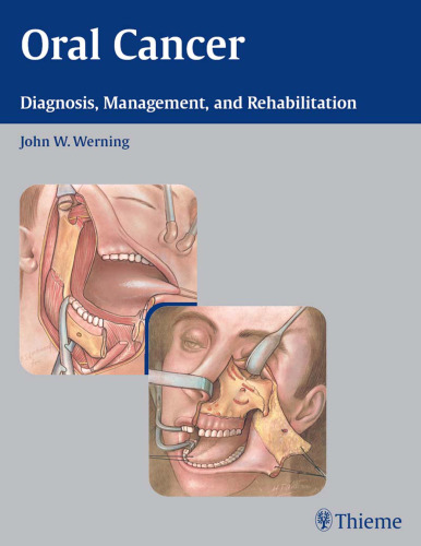 Oral cancer: diagnosis, management, and rehabilitation