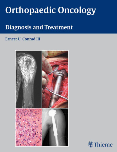 Orthopaedic oncology: diagnosis and treatment