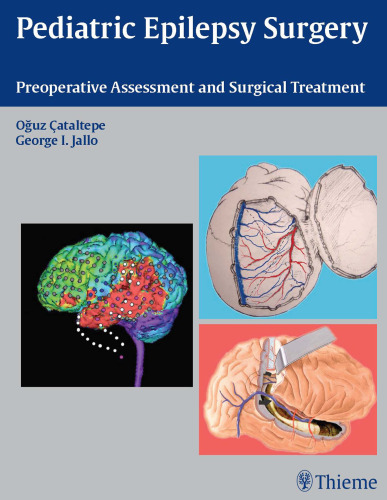 Pediatric epilepsy surgery: preoperative assessment and surgical treatment