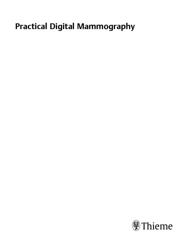 Practical digital mammography