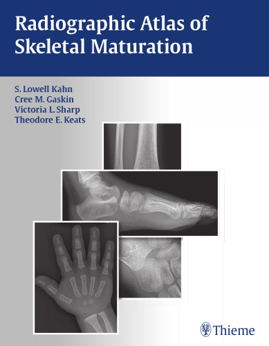 Radiographic atlas of skeletal maturation