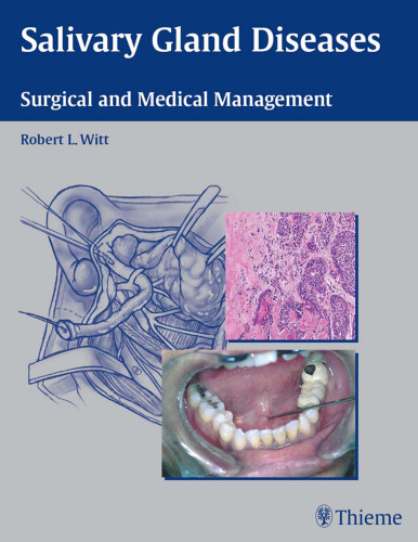 Salivary gland diseases: surgical and medical management