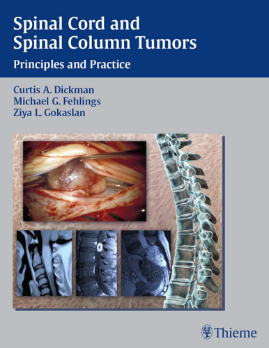 Spinal cord and spinal column tumors: principles and practice