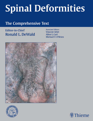 Spinal deformities: the comprehensive text