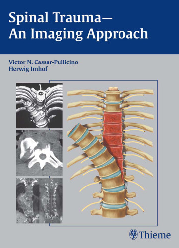 Spinal trauma: an imaging approach