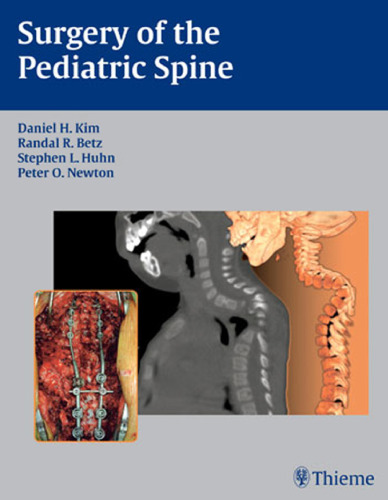 Surgery of the pediatric spine