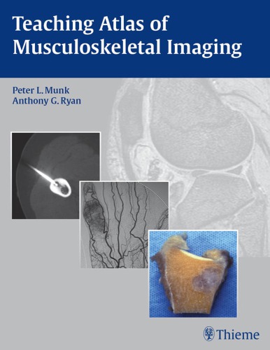 Teaching atlas of musculoskeletal imaging
