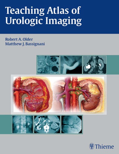 Teaching atlas of urologic imaging