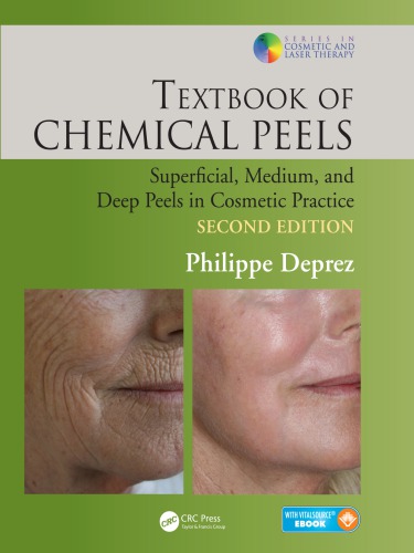 Textbook of chemical peels: superficial, medium, and deep peels in cosmetic practice