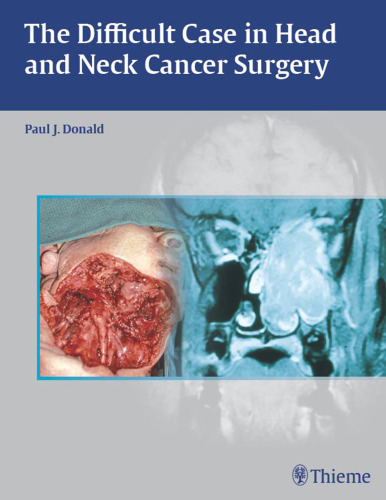 The difficult case in head and neck cancer surgery