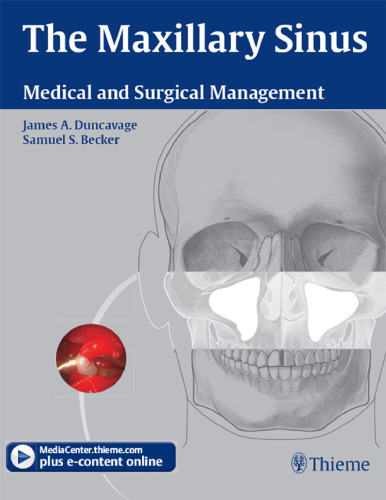 The maxillary sinus: medical and surgical management