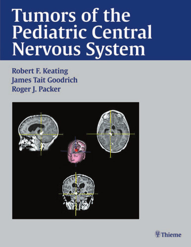 Tumors of the pediatric central nervous system