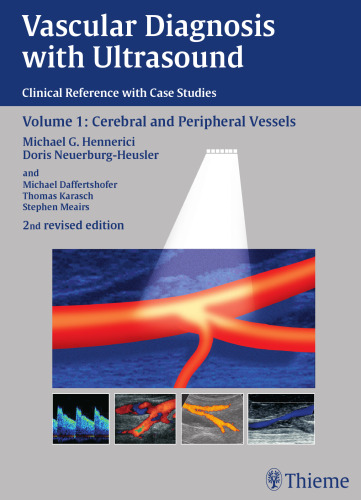 Vascular diagnosis with ultrasound/ 1, Cerebral and peripheral vessels: 49 tables. / Michael G. Hennerici; Doris Neuerburg-Heusler