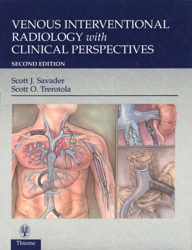 Venous interventional radiology with clinical perspectives