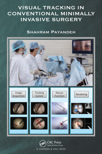 Visual tracking in conventional minimally invasive surgery