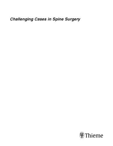 Challening Cases in Spine Surgery