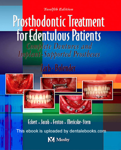 Prosthodontic Treatment for Edentulous Patients: Complete Dentures and Implant-Supported Prostheses