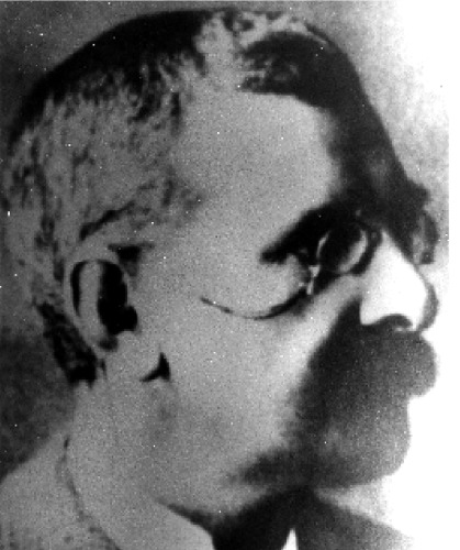 The enzyme treatment of cancer and its scientific basis : being collected papers dealing with the origin, nature, and scientific treatment of the natural phenomenon known as malignant disease