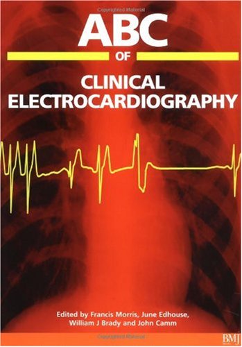 ABC of clinical electrocardiography