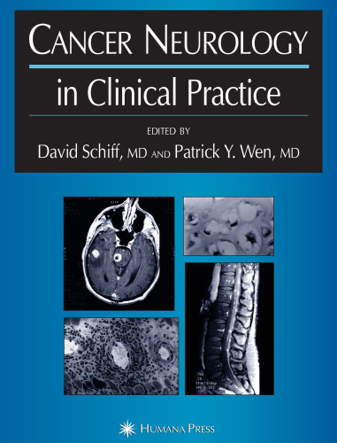 Cancer neurology in clinical practice