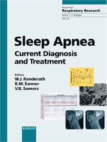 Sleep apnea: current diagnosis and treatment