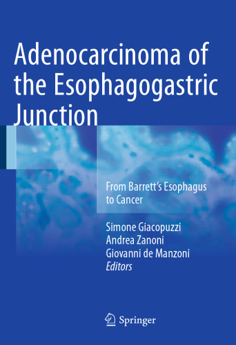 Adenocarcinoma of the Esophagogastric Junction: From Barrett's Esophagus to Cancer