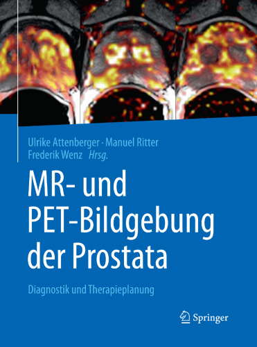 MR- und PET-Bildgebung der Prostata: Diagnostik und Therapieplanung